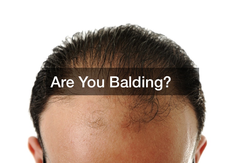 Are You Balding?
